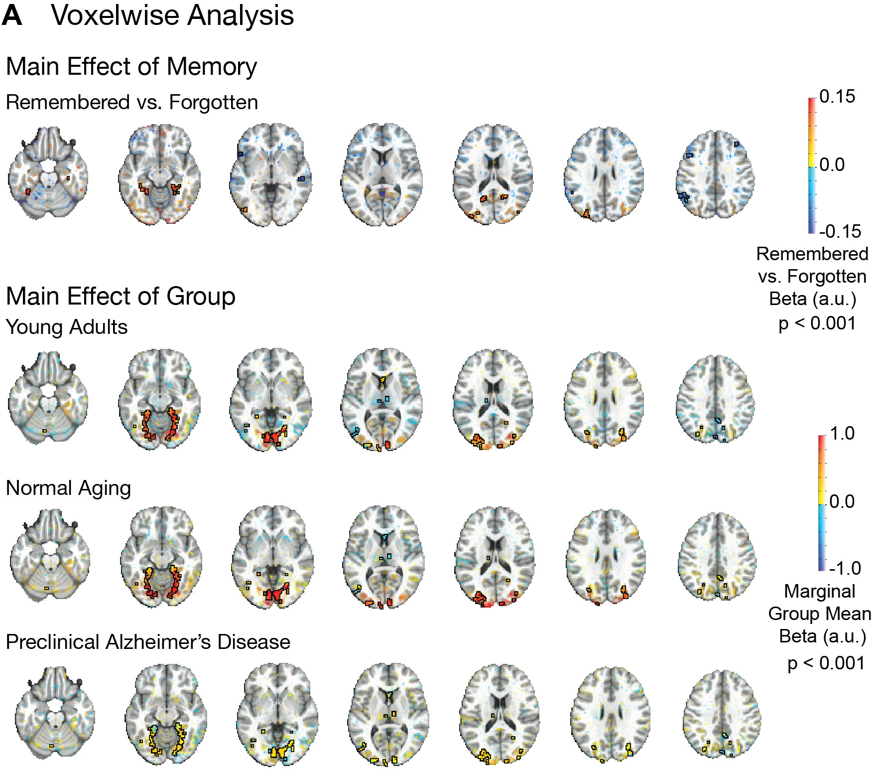 fMRI activation maps